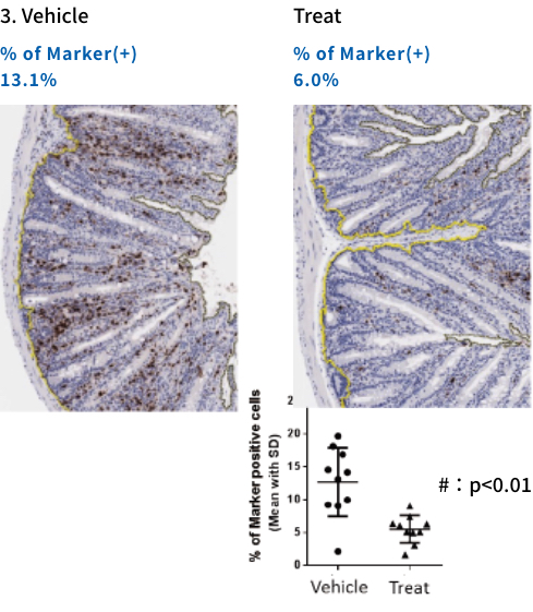 IHC of Neutrophil Marker(myeloperoxidase, MPO) 3. Vehicle Treat