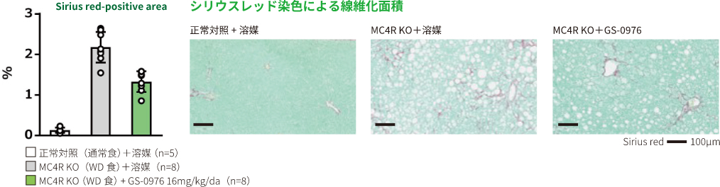 NASH治療薬の創薬 / 病態研究 - Axcelead Drug Discovery Partners株式会社